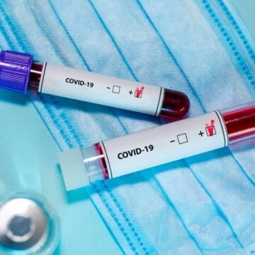 У 12 областях України зафіксували новий штам коронавірусу «Дженні»