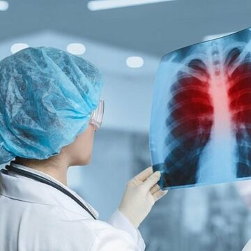 В Івано-Франківській області на понад 17% знизилась захворюваність на туберкульоз