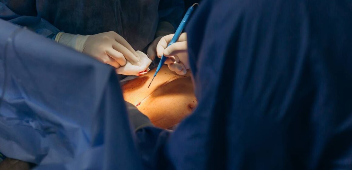 В Івано-Франківській обласній лікарні провели успішну пересадку нирки