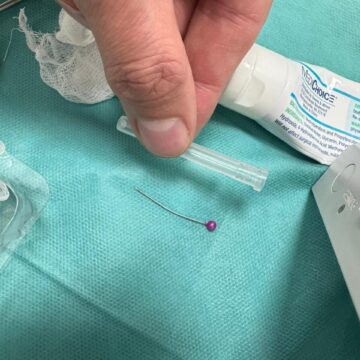 Франківські лікарі дістали з дихальних шляхів дитини шпильку (ФОТО)