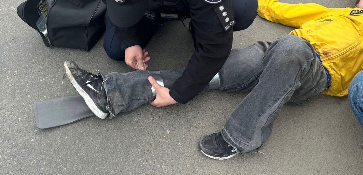 У Франківську хлопчик впав із самоката і травмував ногу: на допомогу прийшли патрульні та перехожі